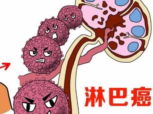 淋巴瘤原因都有哪些
